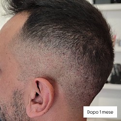 Dopo 1 mese