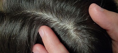 Pulire e Riequilibrare il cuoio capelluto è essenziale. La cute è la terra sana (se curata) dove poter far crescere le nostre piante sane e forti(i capelli).