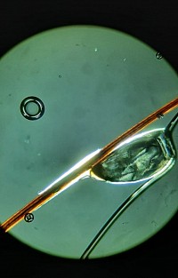 Pediculosi (pidocchi): non sai cosa fare ? Chiedimi aiuto !